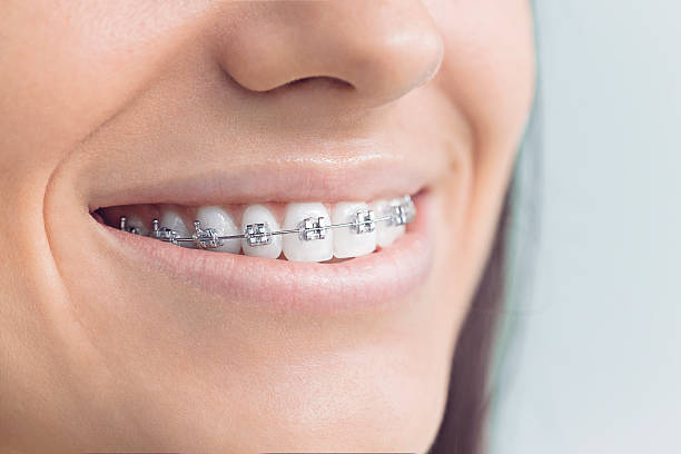 Dental Inlays and Onlays in Island Park, NY